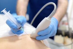 un medico specializzato in radiodiagnostica che esegue un'agobiopsia seno a una paziente